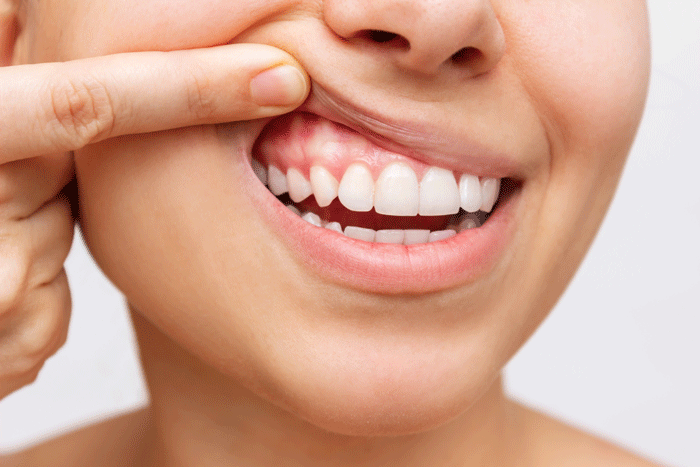 gum-health-cropped-shot-young-woman-showing-healthy-gums